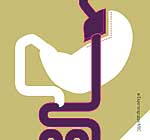 Prinzip der Magenbypass-Operation