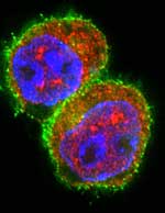 T-Zellen nach Stimulation in Gegenwart von miRNA181a