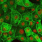 In den Nierenzellen der Ratte wandert das grün markierte Aquaporin AQP2 teilweise zur Zelloberfläche