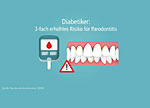 Diabetes: 3-fach erhöhtes Risiko für Parodontitis.